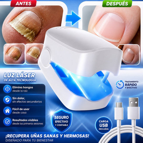 Dispositivo Laser para Hongos en las Uñas